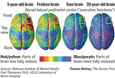 brain1